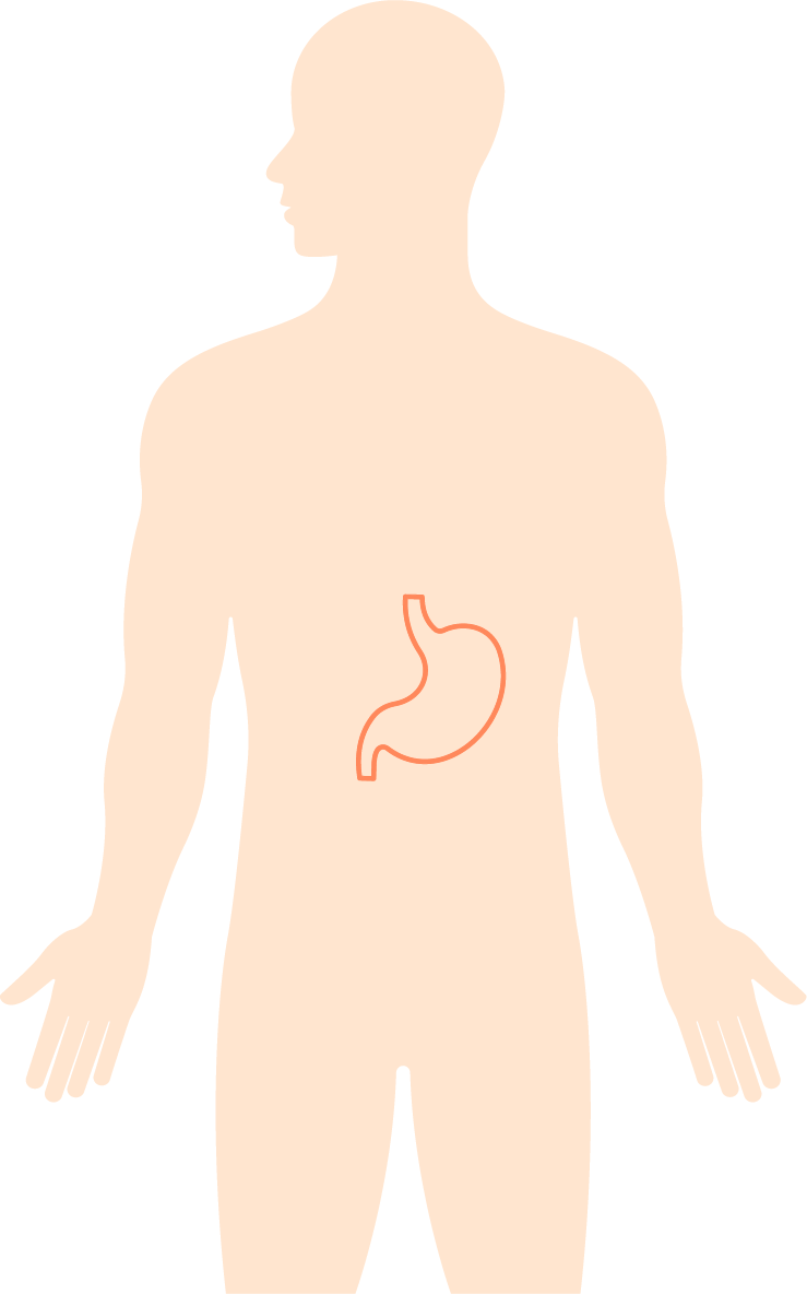 胃鏡 — 男性部位示意圖