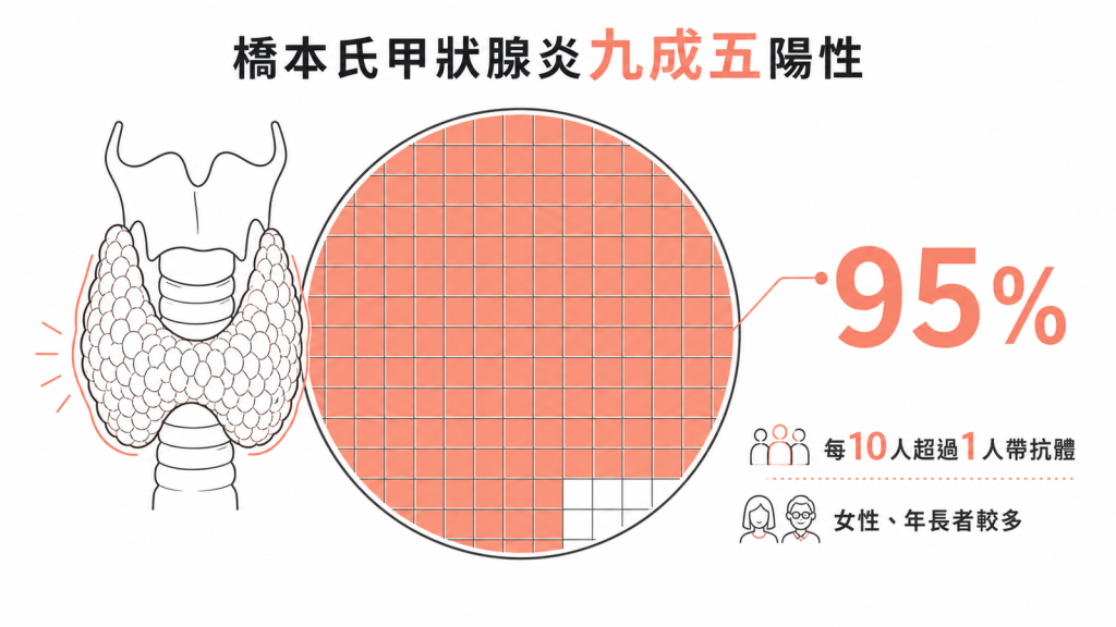 橋本氏甲狀腺炎患者約95%驗出Anti-TPO抗體偏高，每10人超過1人帶抗體女性年長者較多