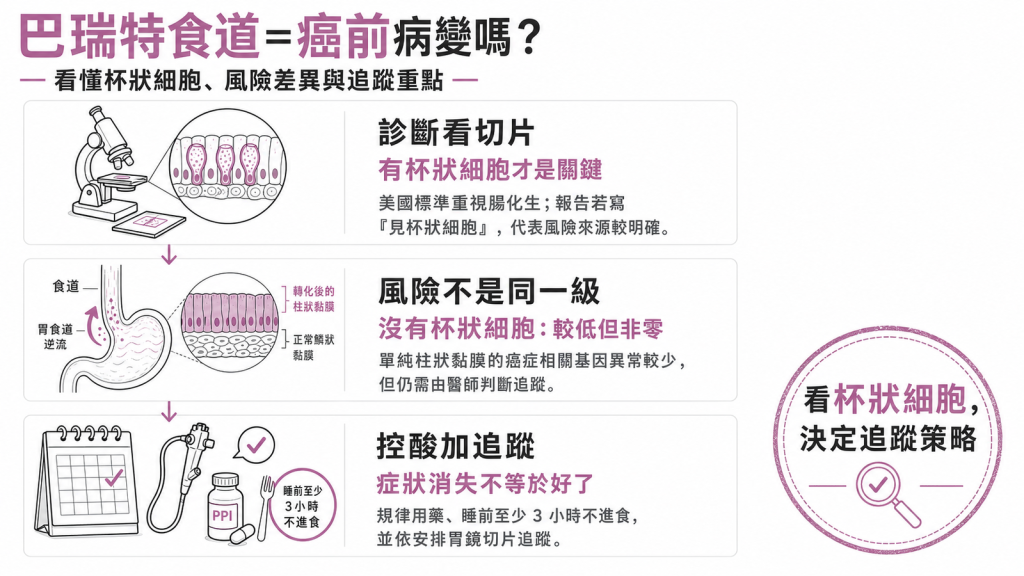 巴瑞特食道是否為癌前病變資訊圖：杯狀細胞、風險差異與追蹤重點
