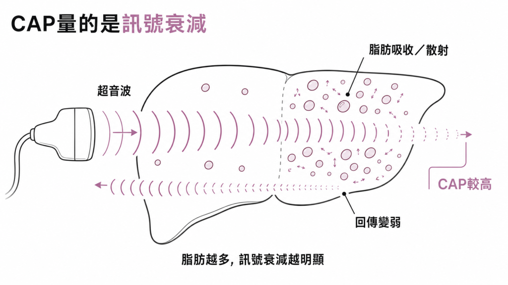 CAP 量超音波穿過肝臟的訊號衰減：脂肪越多衰減越明顯、CAP 越高