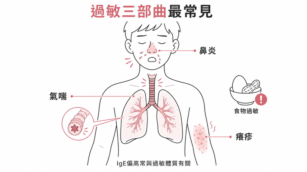 IgE偏高最常見是過敏三部曲:過敏性鼻炎打噴嚏、氣喘、異位性皮膚炎癢疹,常加食物過敏