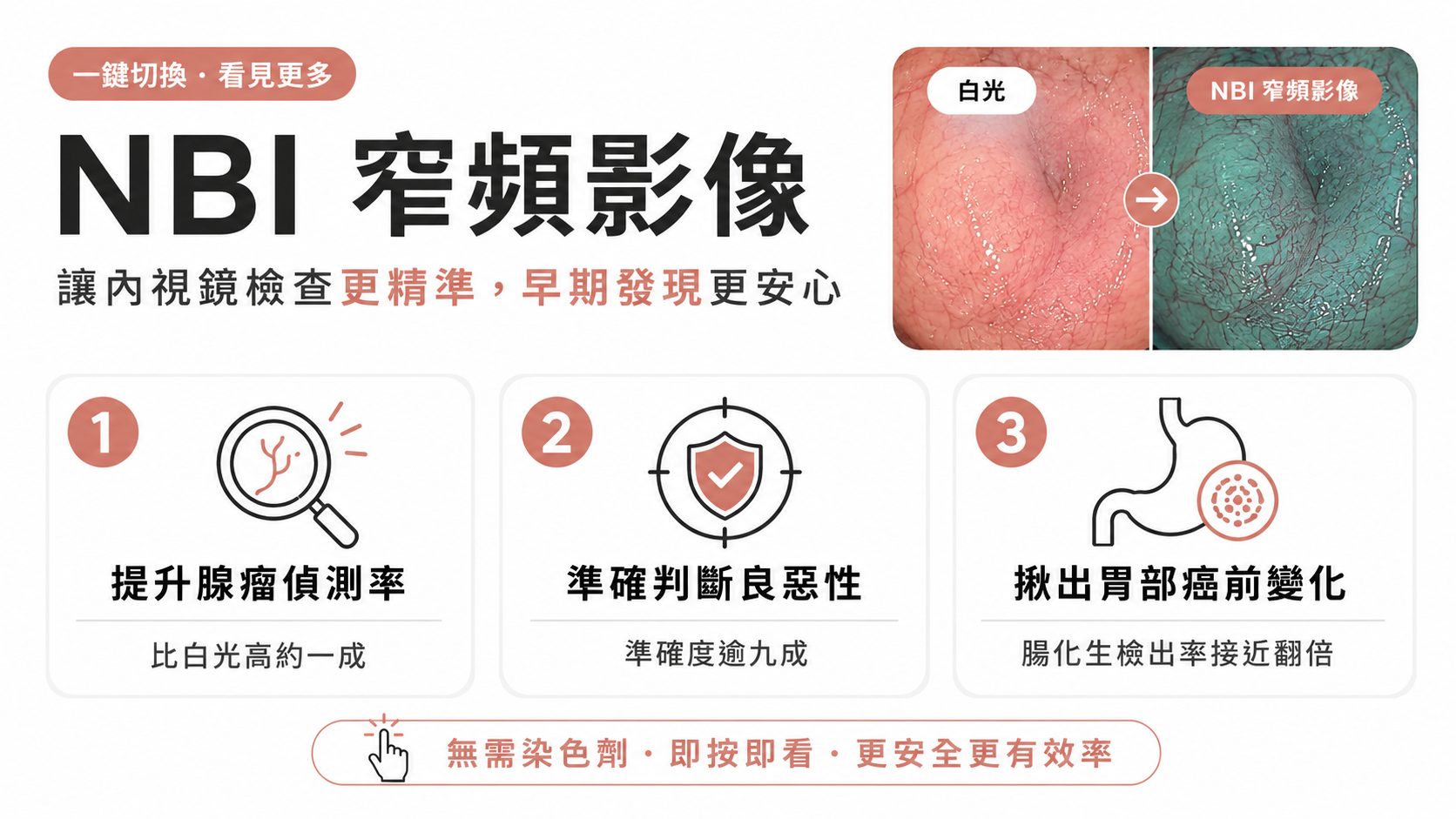 胃腸鏡的 NBI 窄頻影像有用嗎?研究:大腸瘜肉多揪 14%、胃部腸化生偵測率近翻倍