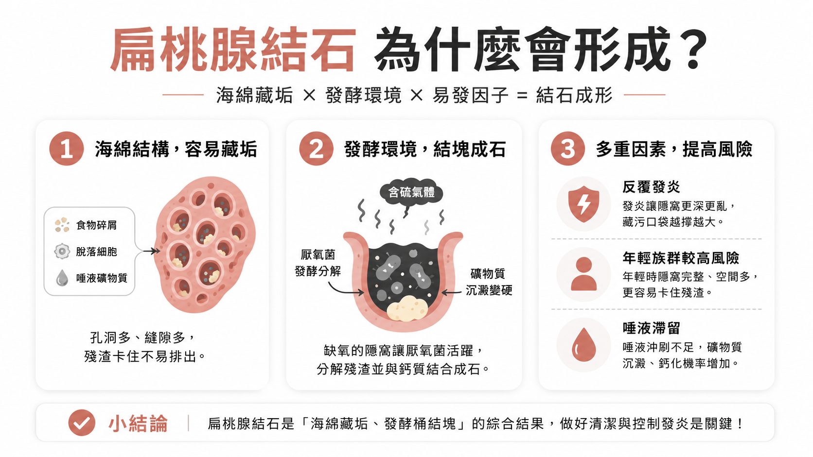 喉嚨卡卡、嘴巴有怪味？可能是扁桃腺結石在作怪，多數免開刀