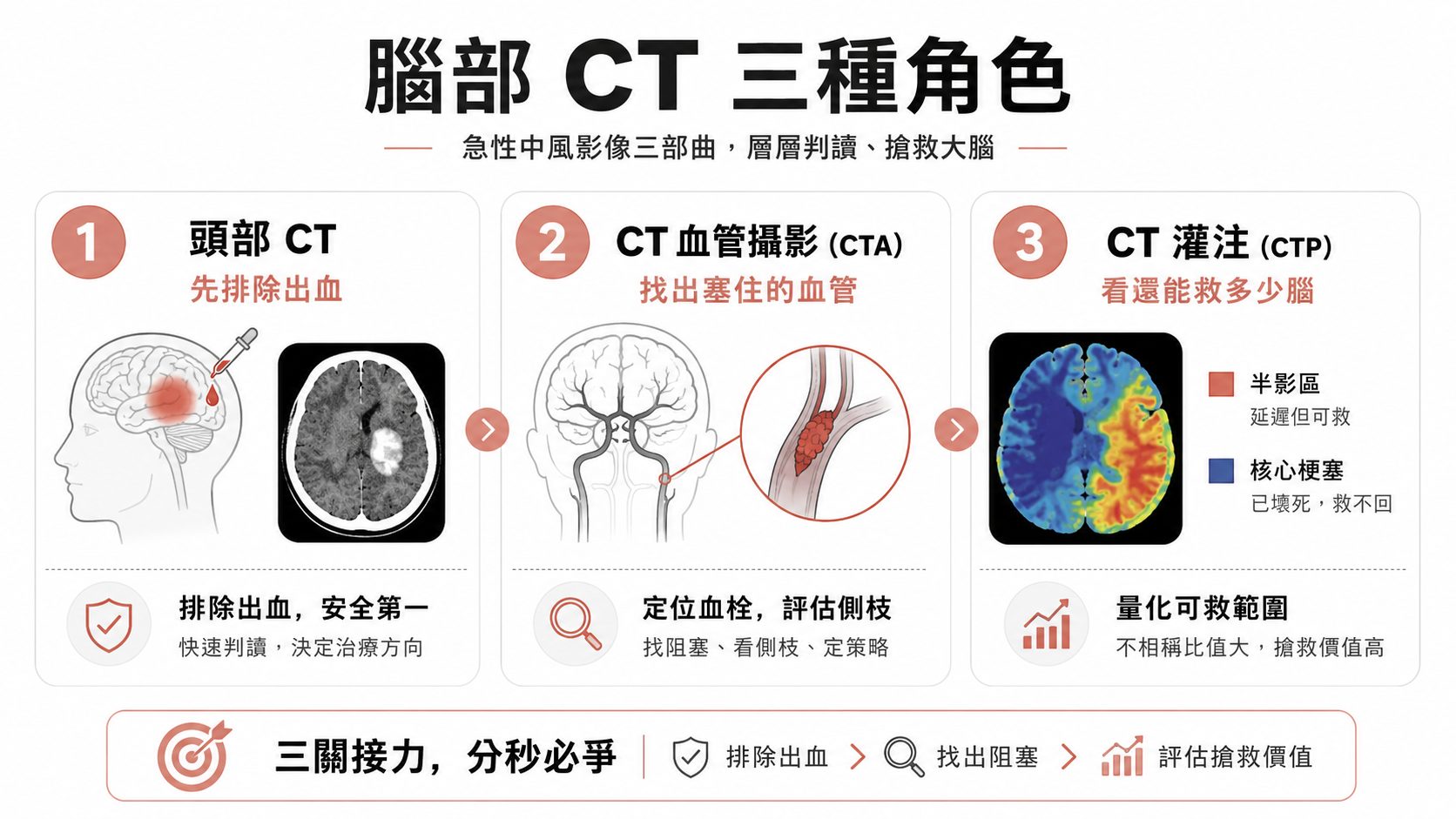 腦中風為什麼要連照三種腦部 CT?頭部 CT、CT 血管攝影、CT 灌注一次看懂