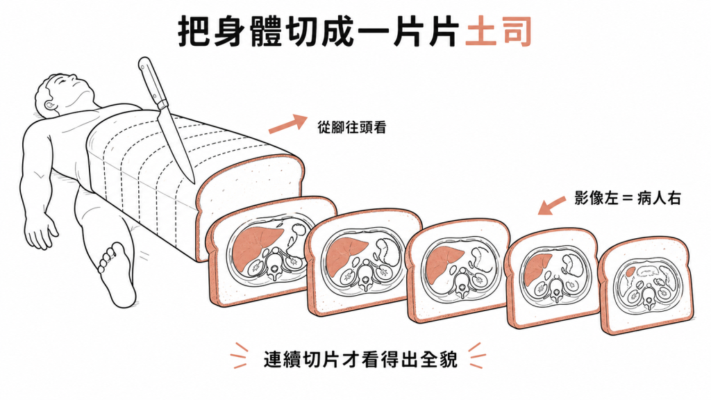 腹部CT像把身體切成一片片土司的橫切面，從腳往頭看、影像左邊其實是病人右邊，一片接一片連起來才看得出全貌