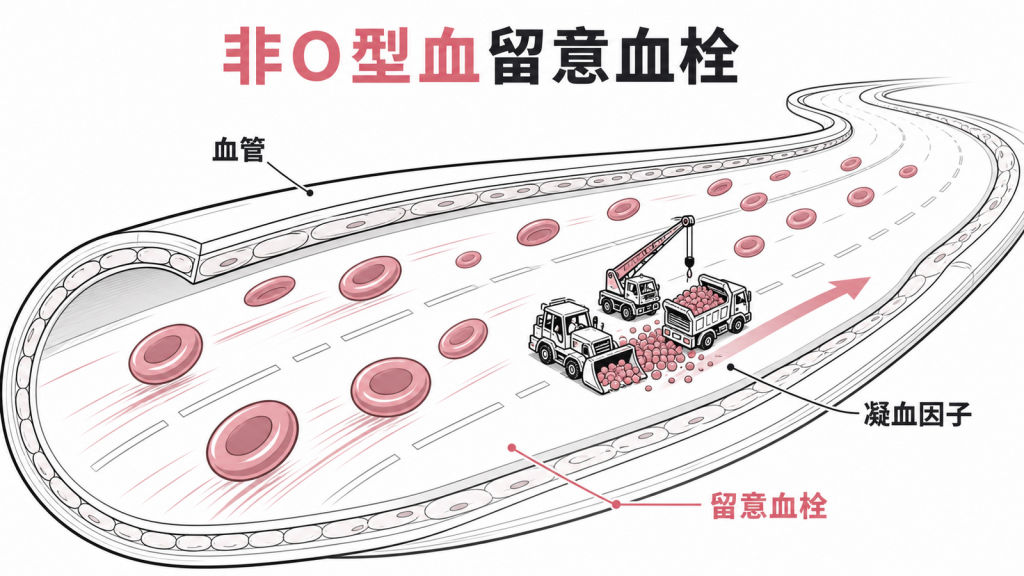 非O型血需留意血栓與心血管風險