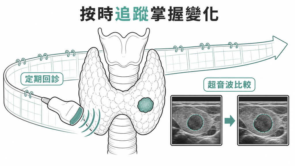 需要追蹤的甲狀腺結節應按醫囑定期回診