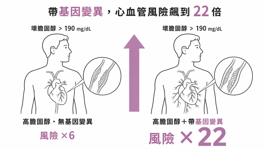壞膽固醇超過190且帶基因變異冠心病風險22倍無基因突變僅約6倍