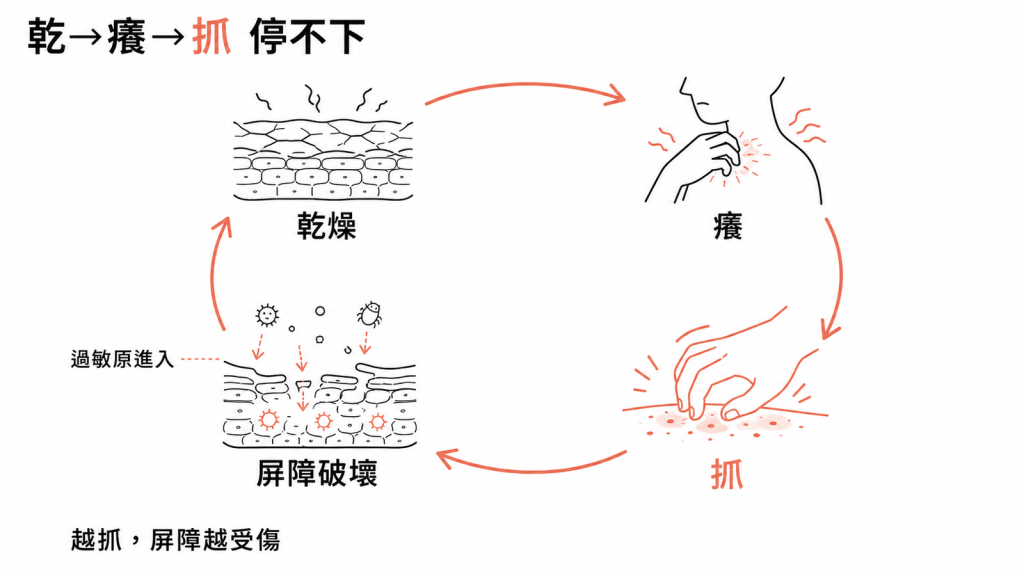 異位性皮膚炎的惡性循環：乾燥到癢、忍不住抓、抓破屏障讓過敏原進入發炎、更乾更癢，越抓屏障越受傷