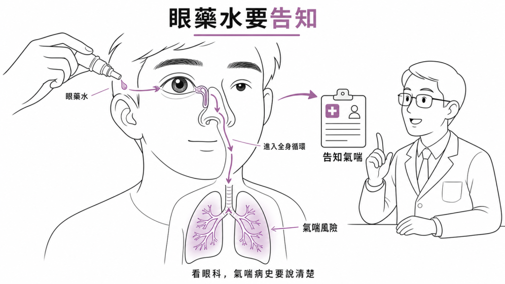 青光眼 beta-blocker 眼藥水的全身吸收路徑:經結膜與鼻淚管進入全身循環影響氣管,看眼科時務必告知氣喘病史