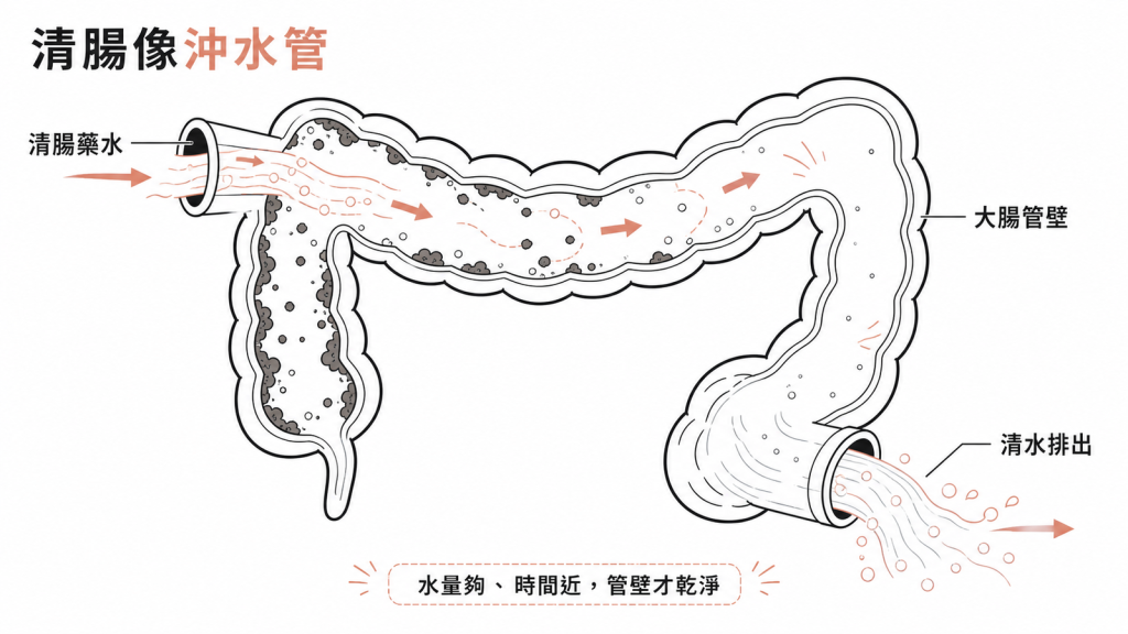 清腸像沖水管：清腸藥水把大腸管壁的殘渣沖刷成清水排出，水量夠、時間近管壁才乾淨