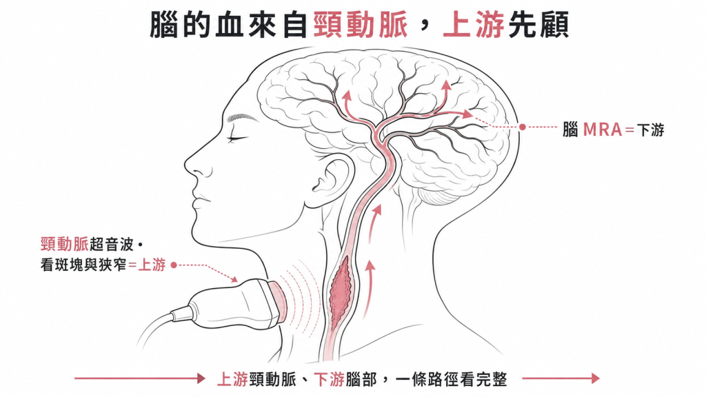 頸動脈超音波看上游斑塊狹窄,與腦MRA一上一下看完整供血路徑