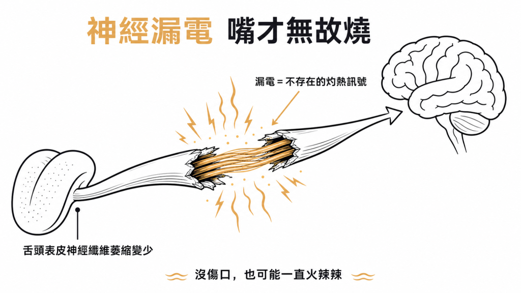舌頭感覺神經像絕緣皮磨損的電線漏電，傳出不存在的灼熱訊號，嘴裡沒傷口卻一直燒