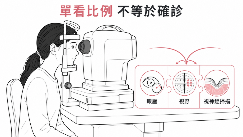 杯盤比偏高需結合眼壓視野與視神經掃描評估