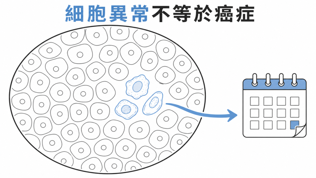 子宮頸抹片細胞異常是提醒追蹤而不等於癌症的衛教圖