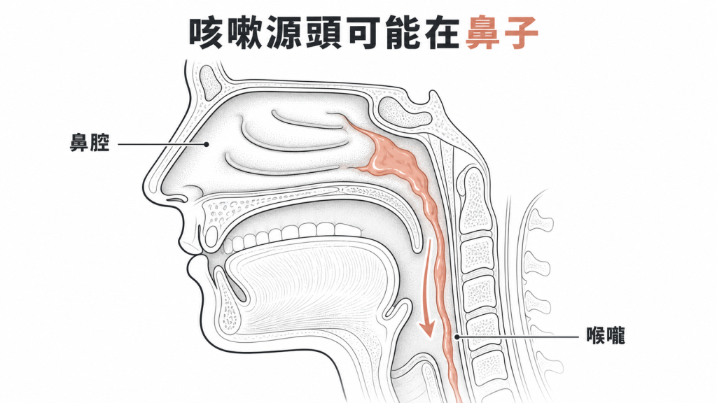 鼻涕倒流可持續刺激喉嚨引發慢性咳嗽