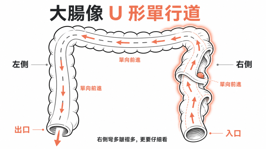 大腸像U形單行道,右側是偏遠彎多的路段更容易漏看瘜肉