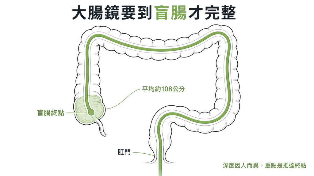 完整大腸鏡要從肛門把鏡管送到最深處的盲腸平均約108公分深度因人而異重點是有沒有抵達盲腸終點