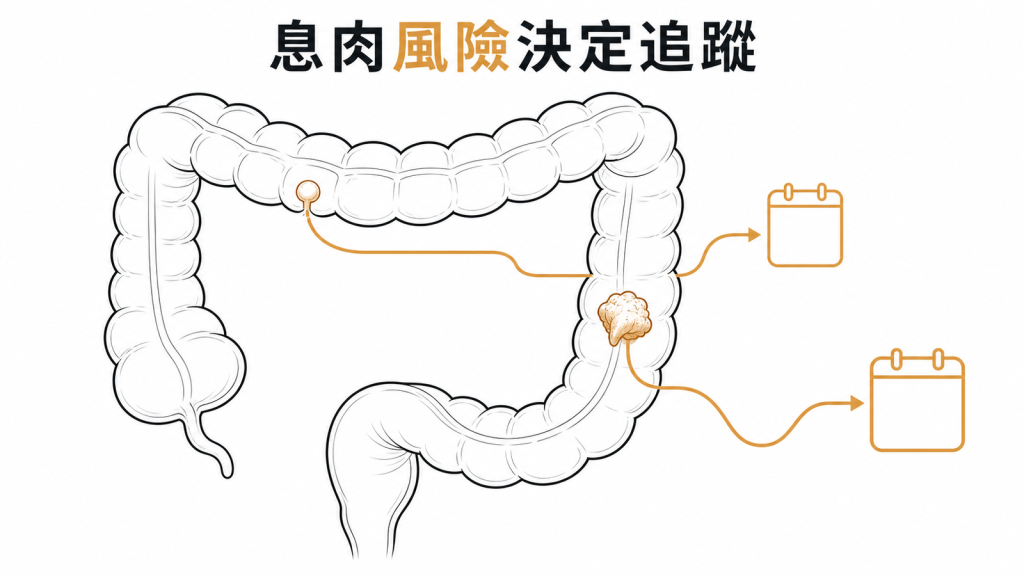大腸息肉特徵決定追蹤風險的衛教圖