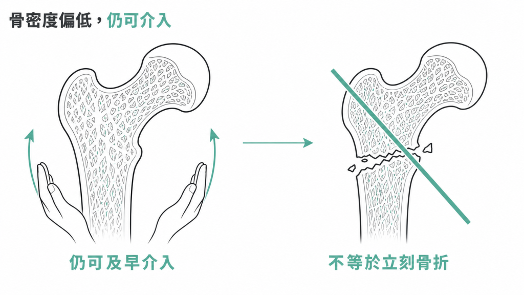 骨密度偏低不等於立刻骨折,中間仍有及早介入的空間