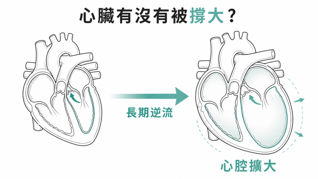 心臟腔室變大是瓣膜逆流負擔的重要指標