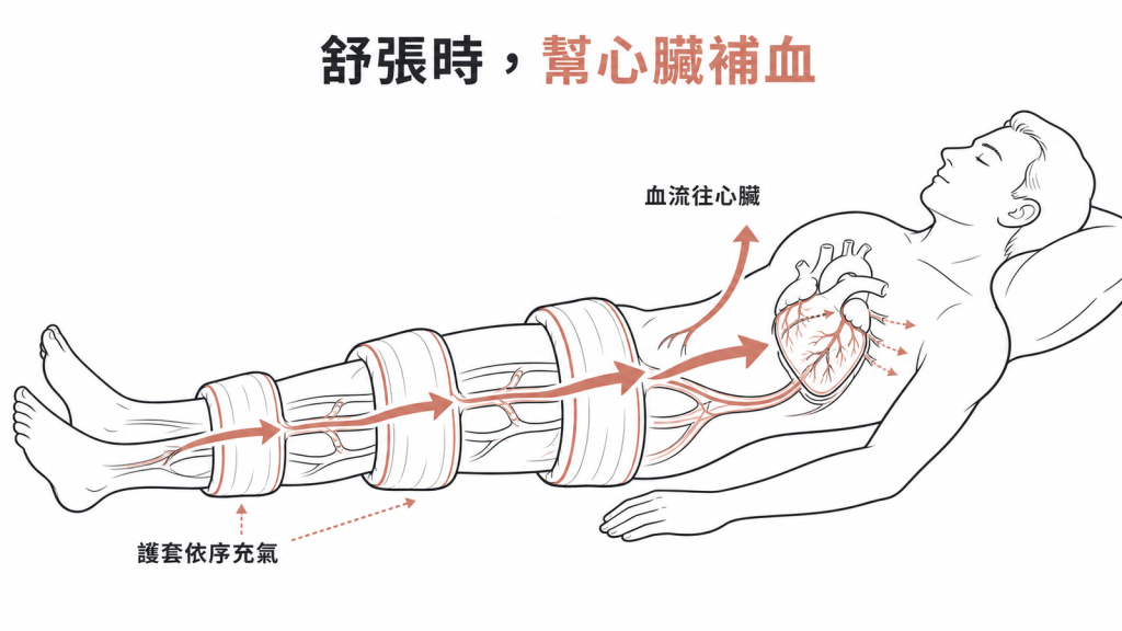 EECP舒張期示意圖:三對護套依序充氣,把下半身血液往心臟方向擠回、增加冠狀動脈供血