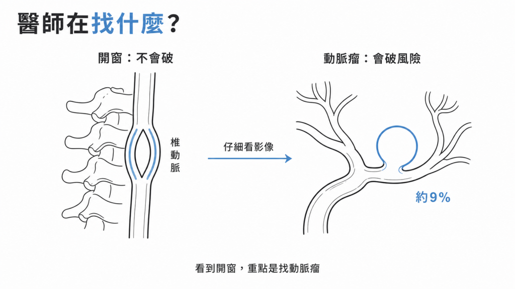 椎動脈開窗與顱內動脈瘤對照圖:開窗不會破,動脈瘤有破裂風險,約 9% 的開窗患者同時帶有動脈瘤