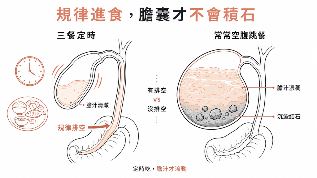 三餐定時讓膽囊規律排空膽汁清澈,常空腹跳餐膽汁濃稠易沉澱結石