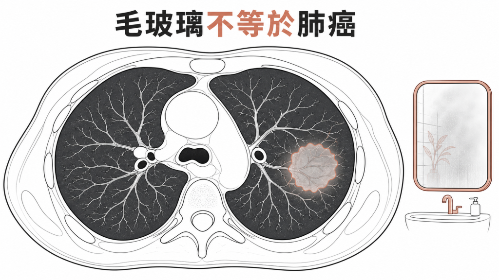 毛玻璃結節像肺部影像中的霧氣