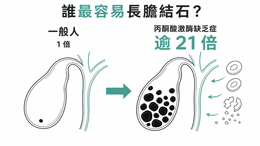 丙酮酸激酶缺乏症的膽結石風險超過一般人 21 倍，膽囊內為黑色色素結石