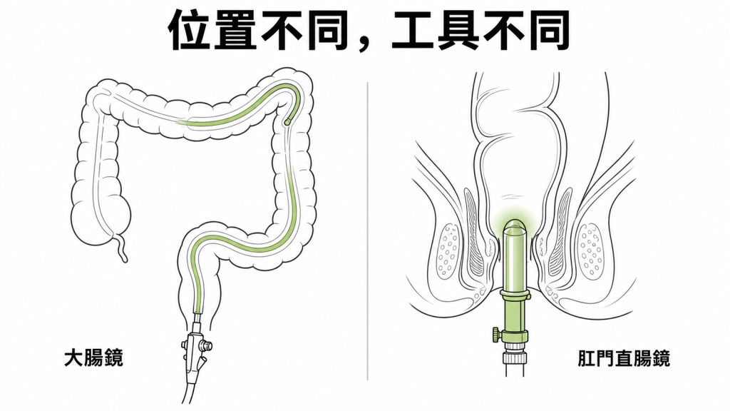 大腸鏡與肛門直腸鏡適用位置不同,需由醫師評估