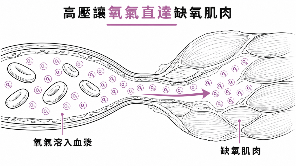 高壓環境讓氧氣直接溶入血漿,送到血流較差的缺氧肌肉