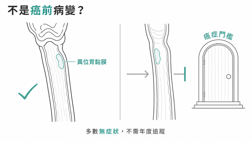 入口斑不是癌前病變:異位胃黏膜被擋在癌症門檻之外,多數無症狀不需年度追蹤