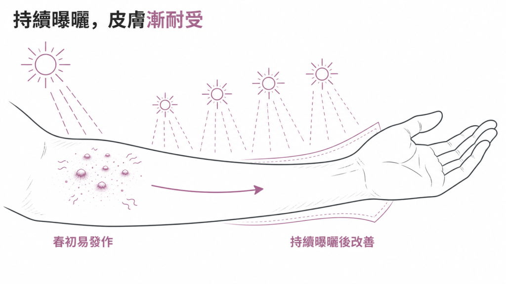 多形性日光疹硬化效應圖:春初初曬易發作,隨持續曝曬皮膚建立耐受度而改善