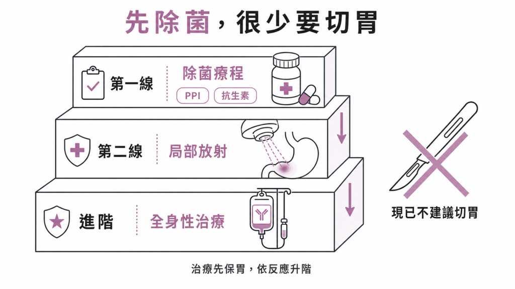 第一線除菌療程PPI加抗生素，第二線局部放射，進階才全身性治療，現已不建議切胃
