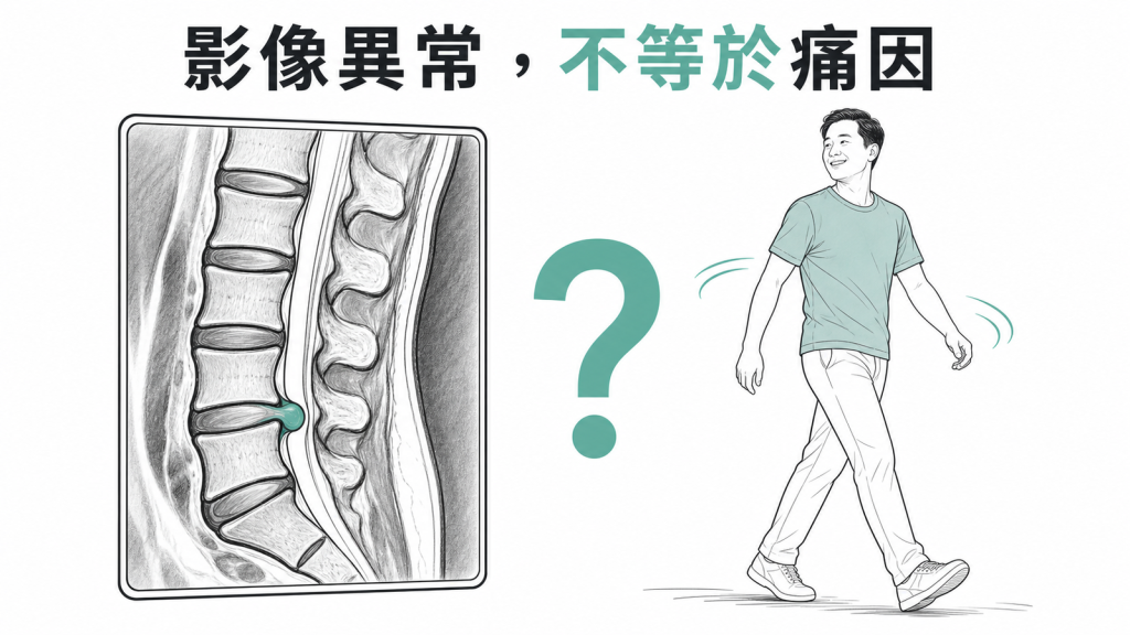 脊椎影像異常不一定等於疼痛來源線稿圖