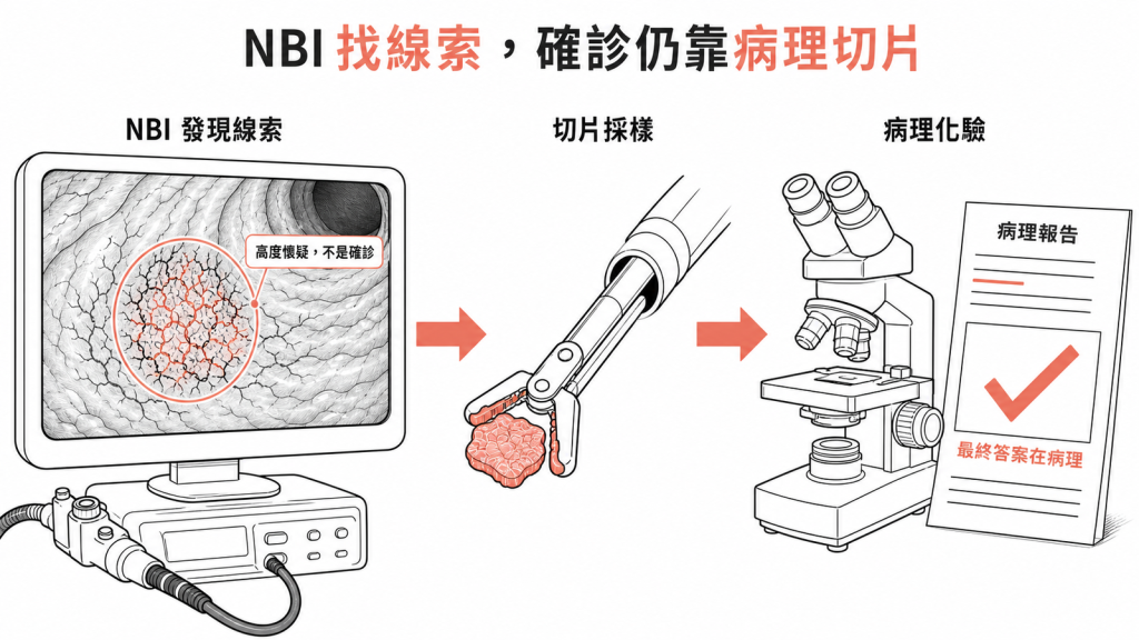 NBI是找線索工具高度懷疑不是確診最終仍靠切片病理化驗確診