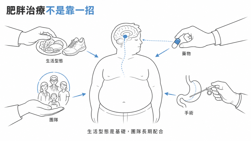 肥胖治療不是靠一招資訊圖：生活型態、藥物、手術、團隊多管齊下