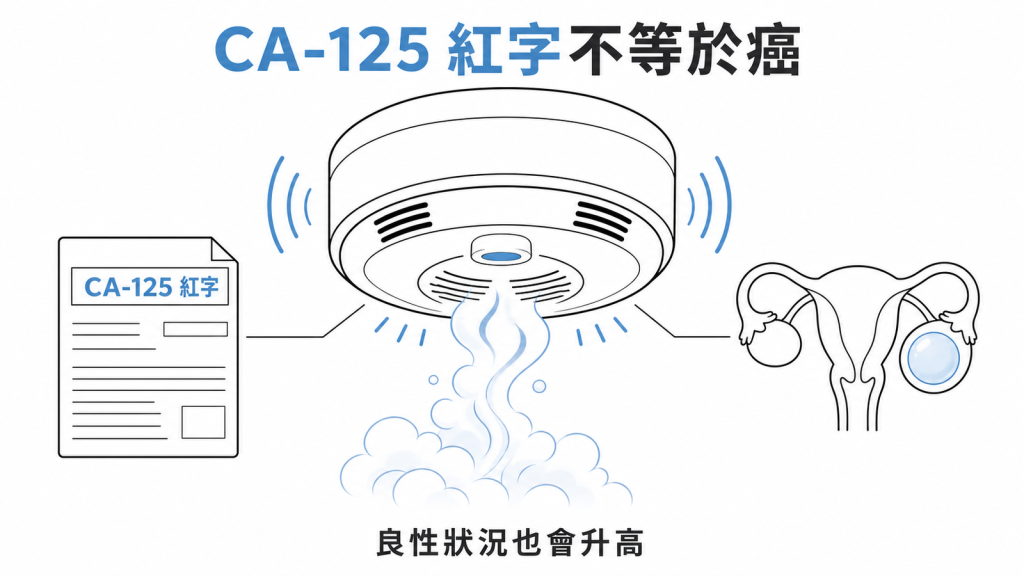 CA-125紅字可能來自良性狀況而不等於卵巢癌