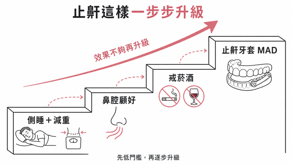 止鼾一步步升級先從側睡減重鼻腔顧好戒菸酒等低門檻做起效果不夠再升級到牙醫訂做的止鼾牙套MAD