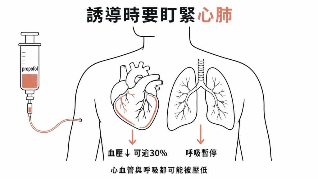 Propofol 誘導時的心肺衝擊：動脈血壓可下降超過 30%，並常伴隨呼吸暫停
