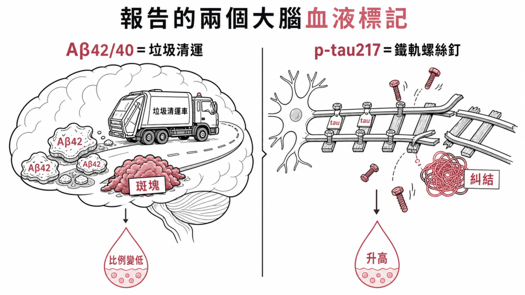 兩個大腦血液標記:Aβ42/40像垃圾清運黏性Aβ42堆積成斑塊使血中比例變低、p-tau217像神經鐵軌螺絲釘磷酸化脫落糾纏使血中升高