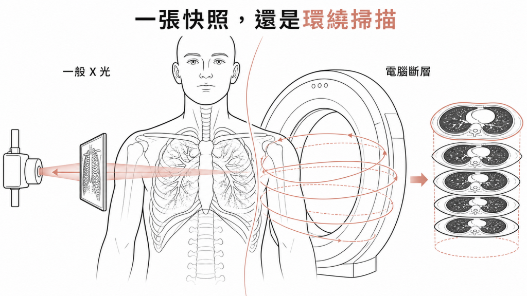一般X光與電腦斷層取像方式差異示意圖
