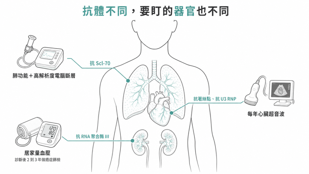 依抗體安排監測示意圖:抗 Scl-70 盯肺做肺功能與高解析度電腦斷層、抗著絲點與抗 U3 RNP 每年心臟超音波、抗 RNA 聚合酶 III 居家量血壓