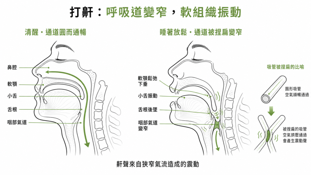 打鼾是睡著放鬆呼吸道像被捏扁吸管變窄軟顎懸雍垂舌根振動發聲仰睡舌根後墜更窄