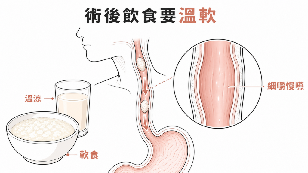食道內視鏡切除後選擇溫涼軟食