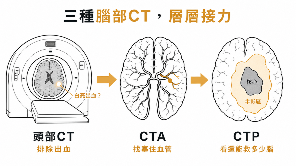 急性中風三種腦部CT接力頭部CT排除出血CTA找塞住的血管CTP看核心梗塞與還能救的半影區