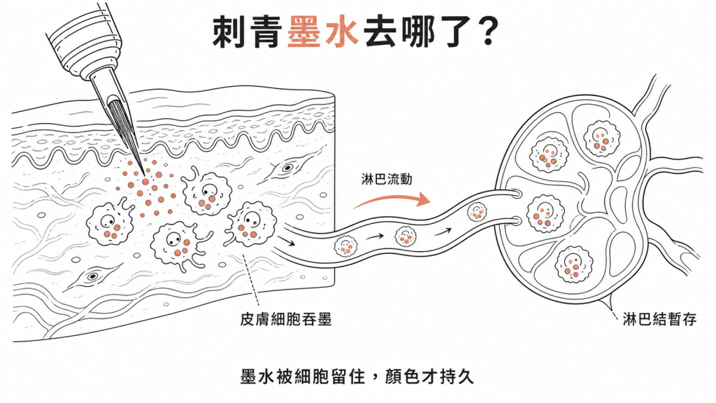 刺青墨水被皮膚的巨噬細胞與單核球吞掉，順淋巴流動累積到附近淋巴結暫存，免疫反應主要在局部