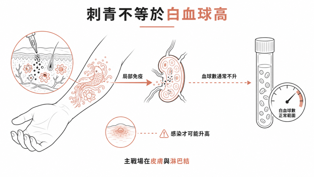 刺青的免疫主戰場在皮膚與淋巴結，血液白血球數通常不升，只有感染時才可能明顯升高