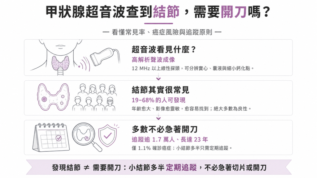 甲狀腺結節與超音波衛教資訊圖:結節常見率、癌症風險與追蹤原則
